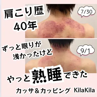 ドライヘッドスパ KilaKilaのエステ・リラクイメージ