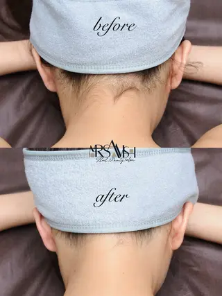 ◯△□所属・最新美肌脱毛 韓国水光肌🫧のその他イメージ