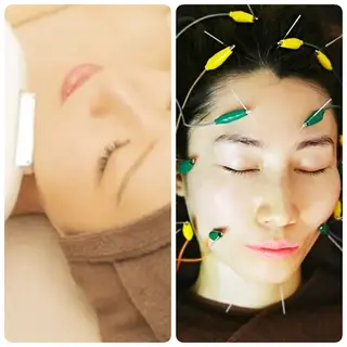 ハリロイヤルトーキョー武蔵小山所属・ニューハーフ鍼灸師 🖤🤍Saya🌹のエステ・リラクイメージ