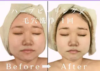 美肌脱毛＆小顔・フェ イシャル【SONA】のエステ・リラクイメージ