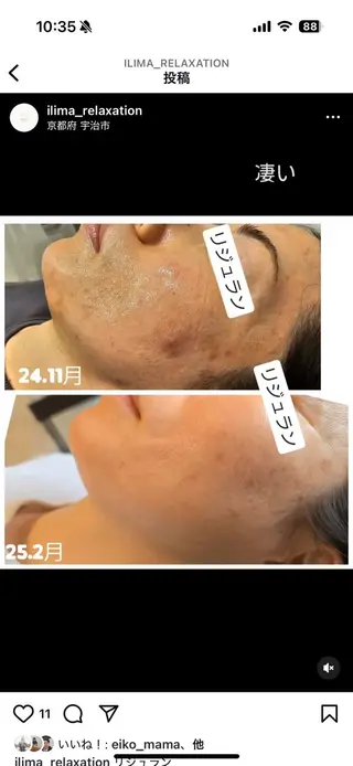 ilima NARUMIのエステ・リラクイメージ