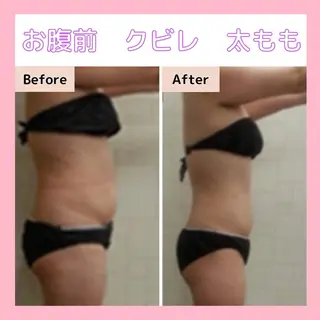 エステサロン　Sブランペタル所属・三沢市エステサロン Sブランペタルのエステ・リラクイメージ