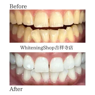 ホワイトニング ショップ吉祥寺店のエステ・リラクイメージ