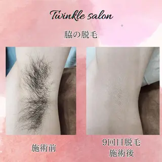 メンズ 中井 光明の眉毛・アイブロウイメージ