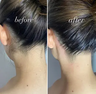 エピナス町田店 ブラジリアンワックスのエステ・リラクイメージ