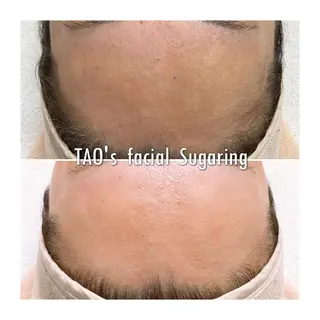 Sugaring / HILOT TAOのエステ・リラクイメージ