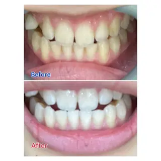 MBEAUTYSALON 千葉店・京成大久保所属・Melty 輝のその他イメージ