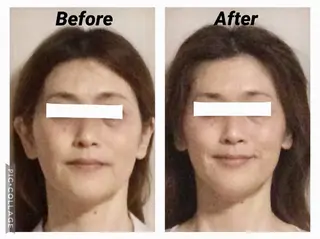 小顔矯正Sho  FaceDesignのエステ・リラクイメージ