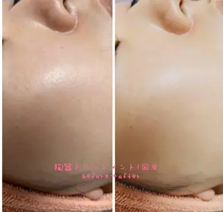 EYE LASH LAPISのエステ・リラクイメージ