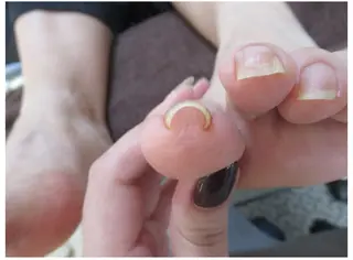 ネイル ネイルサロンailes所属・ネイルサロンエール 店長沼尻のネイルデザイン