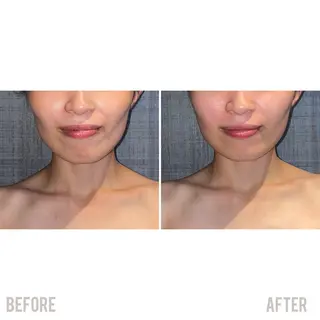 こりとりコルギ専門店MIICO所属・こりとりコルギ専門店 勝　友里奈のエステ・リラクイメージ