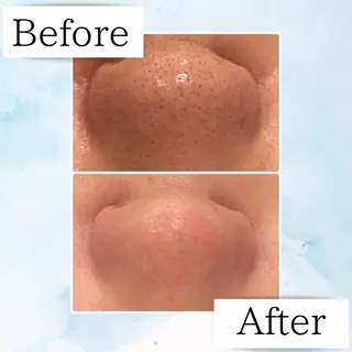 Beauty SalonEclatのエステ・リラクイメージ