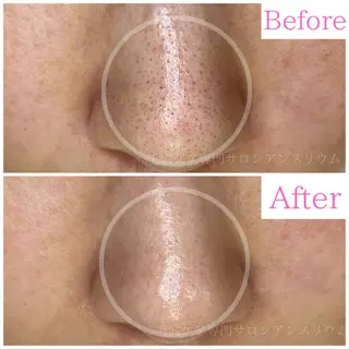 毛穴ケア専門サロンアンスリウム所属・茨城土浦 つくば毛穴 ケア専門サロンのエステ・リラクイメージ