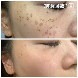 Porte beauteオーナーのエステ・リラクイメージ