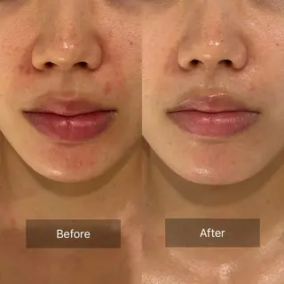 mine.mマインエム所属・mine.mi マインエムのエステ・リラクイメージ