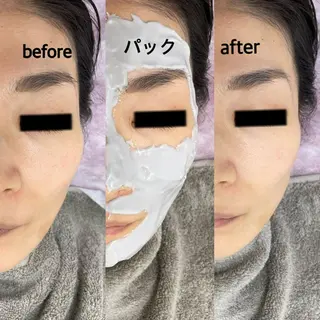 肌ケア＆毛穴洗浄 Cheriのエステ・リラクイメージ