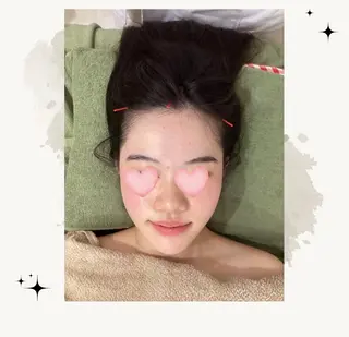 さくらんぼ鍼灸院所属・美容鍼&温活・免活 さくらんぼ鍼灸院のエステ・リラクイメージ