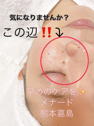 メナード熊本 嘉島のエステ・リラクイメージ