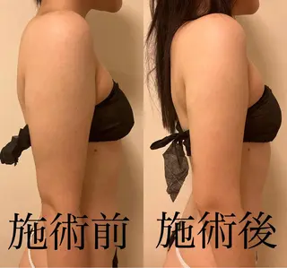 WOM SALON所属・MIKU【美容整形ダ ウンタイムケア銀座】のエステ・リラクイメージ