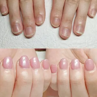 ネイル 深爪矯正/爪育成ケア manie nailのネイルデザイン