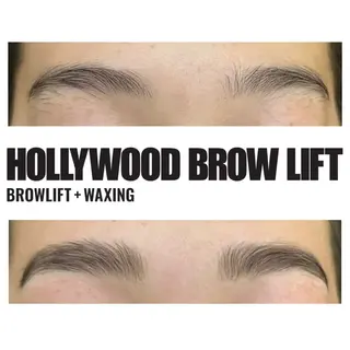 美容鍼灸整体サロンBeauJu所属・小顔矯/美容鍼/鍼灸 BeauJuのその他イメージ