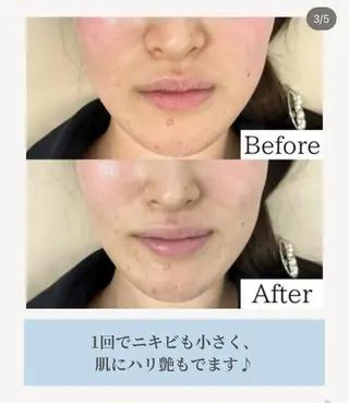 Jessica 森のマツエク・マツパデザイン