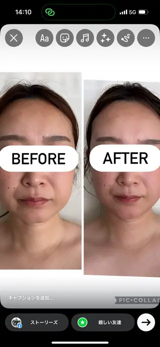 【三軒茶屋/下馬】 本格痩身・よもぎ蒸しのエステ・リラクイメージ