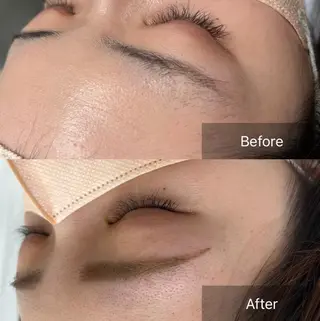 アイブロウ for woman所属・森 美優のエステ・リラクイメージ