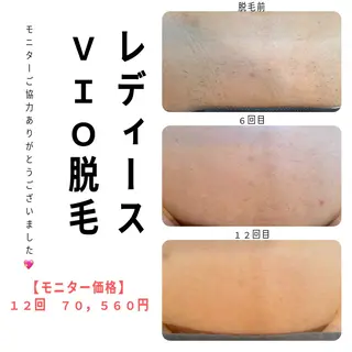 private脱毛salon HALE所属・private脱毛 salon HALEのエステ・リラクイメージ