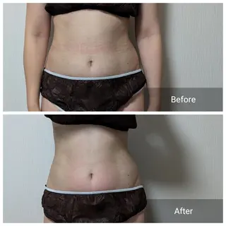 nail RiRi アトレナチュラのエステ・リラクイメージ