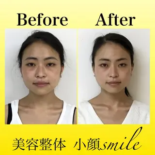 【小顔矯正専門】 小顔smileのエステ・リラクイメージ