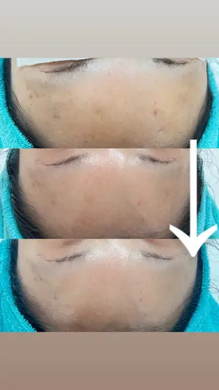 都度払い制脱毛サロンBe Charm所属・Be Charm 山﨑のエステ・リラクイメージ