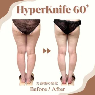 aimer 服部のその他イメージ