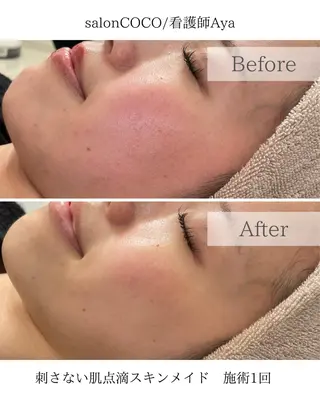 salonCOCO所属・肌管理看護師💎 salonCOCOのエステ・リラクイメージ