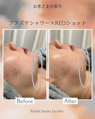 La chic.のエステ・リラクイメージ