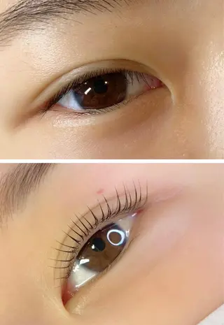 マツエク・マツパ アイラッシュ＆フェイシャルサロン　ベアトリーチェ所属・医療提携美容サロン Beatriceのエステ・リラクイメージ