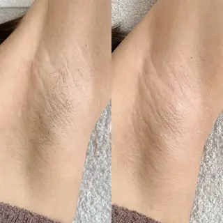 salonLADYSTYLE所属・稲嶺 美華のエステ・リラクイメージ