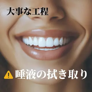 メンズ キッズ ホワイトニングサロン Ecru所属・ホワイトニングサロン Ecru エクリュのその他イメージ