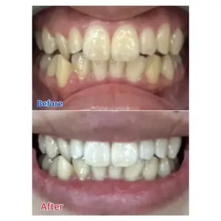 M渋谷店所属・Ｍ渋谷 ホワイトニングのエステ・リラクイメージ