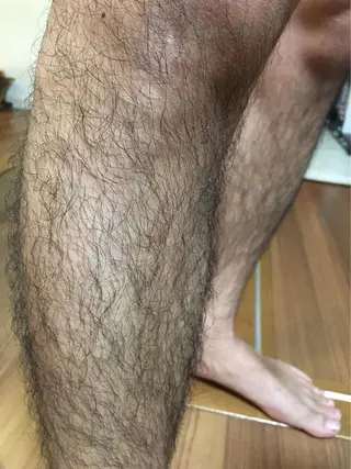 ネイル・脱毛サロンplage所属・脱毛サロン Plageプラージュのエステ・リラクイメージ