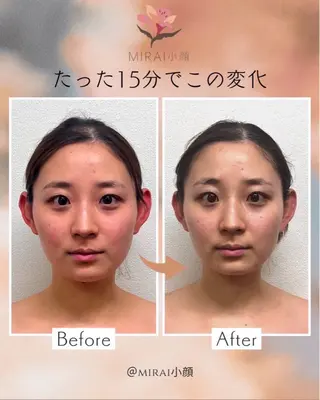 MIRAI小顔 名古屋店のエステ・リラクイメージ