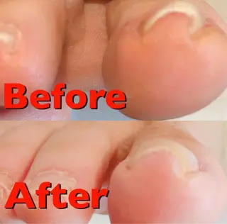 ネイル NAIL SALON ｔｏｇｇｙのネイルデザイン