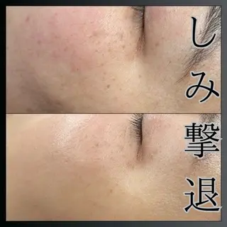 LiZA エステティックサロンのその他イメージ