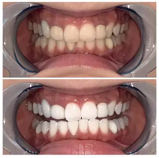 カラー メンズ マツエク・マツパ ネイル ヘアアレンジ パーマ キッズ アイブロウ ロング ライトビューティー 銀座本店のエステ・リラクイメージ