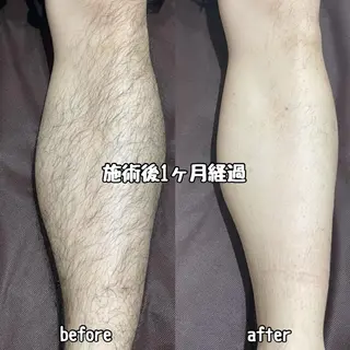 メンズ Diar salon もものエステ・リラクイメージ