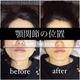 🌈歪み改善🌈 バリンタイ すぎうらのエステ・リラクイメージ