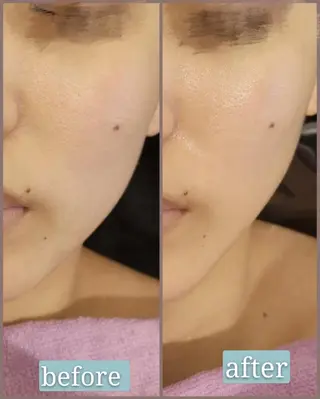 🅖🅤🅩🅔🅛 salonのエステ・リラクイメージ