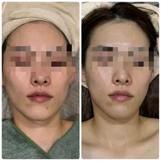 脱毛&フェイシャル 専門店muro.のエステ・リラクイメージ