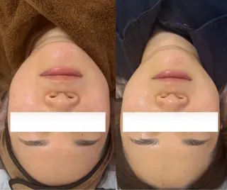 毛穴レス美肌へ🌿 看護師Abe🌼のエステ・リラクイメージ