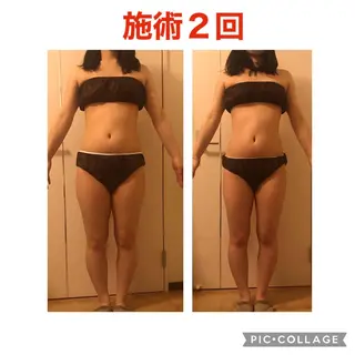 セミロング カラー パーマ ヘアアレンジ メンズ キッズ ネイル マツエク・マツパ アニメ,Vオタク× 即効痩せエステサロンのエステ・リラクイメージ